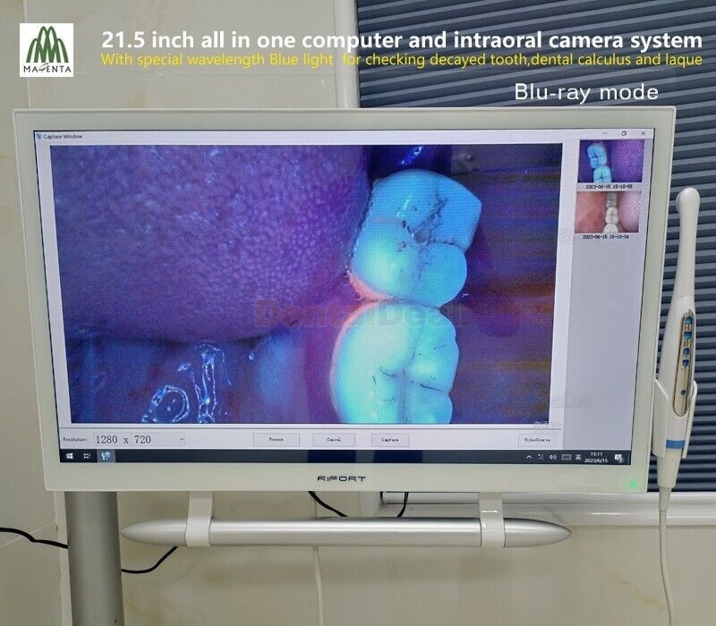 Magenta YF-2200P+ 21.5 Inch Touch Screen Intraoral Camera VGA+HDMI